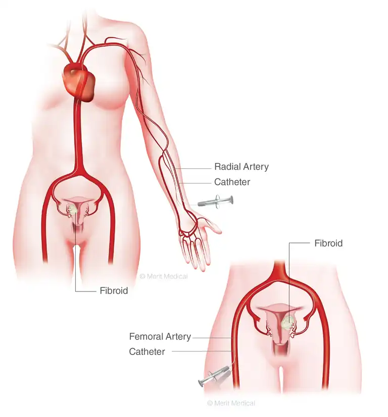 أفضل دكتور أشعة تداخلية | الأشعة التداخلية | مركز الأشعة التداخلية