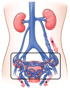 أفضل دكتور أشعة تداخلية | الأشعة التداخلية | مركز الأشعة التداخلية