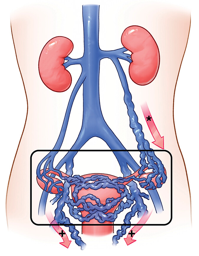 أفضل دكتور أشعة تداخلية | الأشعة التداخلية | مركز الأشعة التداخلية