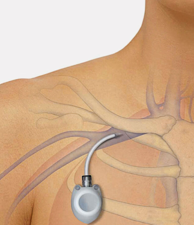 أفضل دكتور أشعة تداخلية | الأشعة التداخلية | مركز الأشعة التداخلية