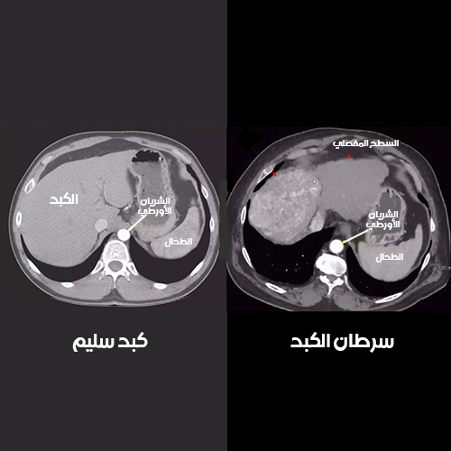 أفضل دكتور أشعة تداخلية | الأشعة التداخلية | مركز الأشعة التداخلية