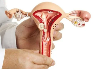 أفضل دكتور أشعة تداخلية | الأشعة التداخلية | مركز الأشعة التداخلية