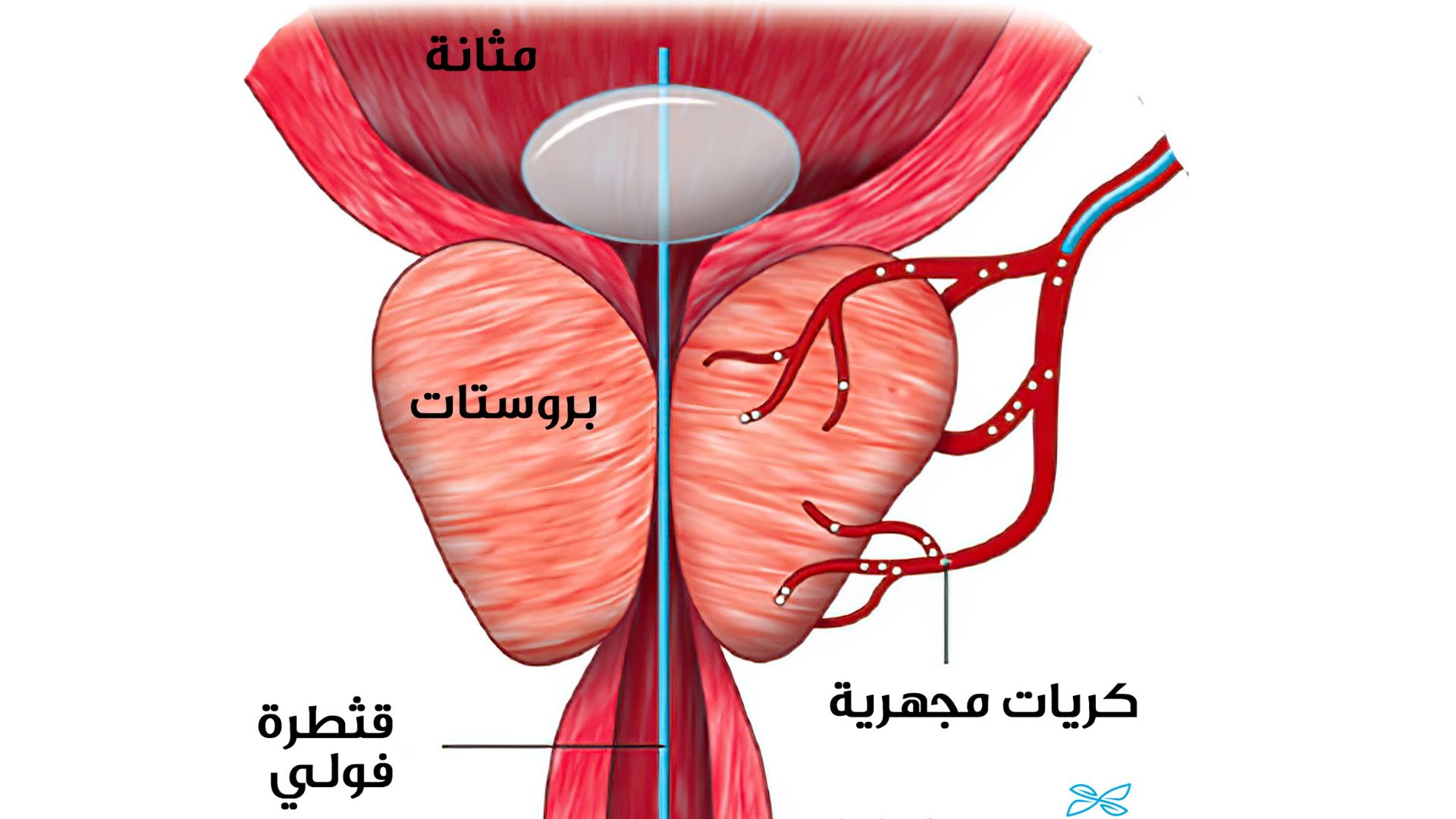 أفضل دكتور أشعة تداخلية في مصر | الأشعة التداخلية | مركز الأشعة التداخلية علاج بدون ألم، وبدون آثار جراحية، وشفاء سريع ومضمون. بديل الجراحة