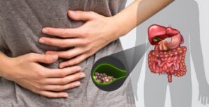 أفضل دكتور أشعة تداخلية | الأشعة التداخلية | مركز الأشعة التداخلية